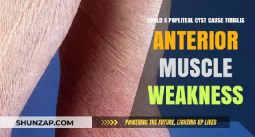 Popliteal Cysts: A Cause of Tibialis Anterior Weakness?