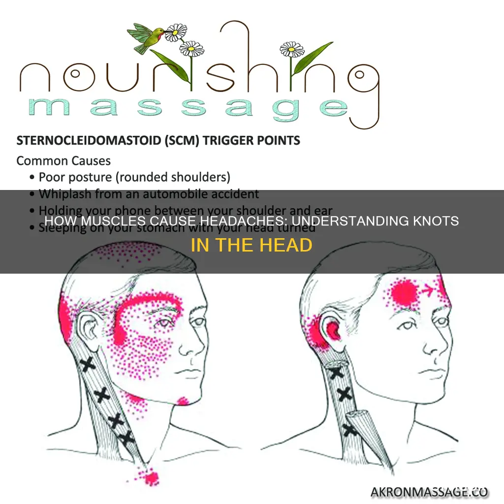 How Muscles Cause Headaches: Understanding Knots In The Head | CyVigor