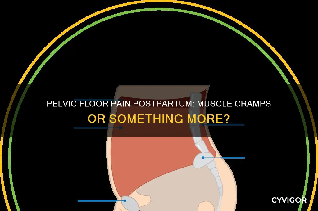 could my pelvic floor pain pp be muscle cramps