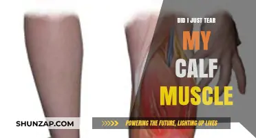 Did I Just Tear My Calf Muscle? Symptoms and Recovery Tips