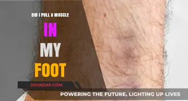 Foot Pain: Did I Pull a Muscle? Symptoms and Solutions