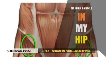 Hip Pain: Signs You Pulled a Muscle and What to Do