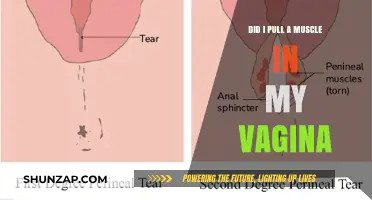 Vaginal Muscle Strain: Understanding Pain and Potential Causes