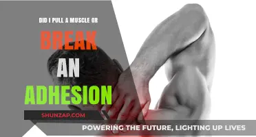 Muscle Pull or Broken Adhesion: Understanding Your Pain and Recovery