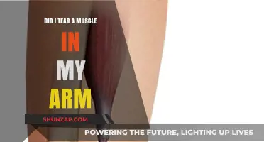 Arm Pain: How to Tell If You've Torn a Muscle