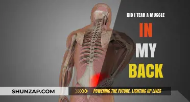 Back Pain Blues: Could You Have Torn a Muscle?