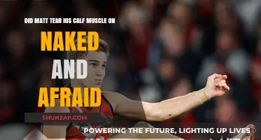 Did Matt Tear His Calf Muscle on Naked and Afraid?