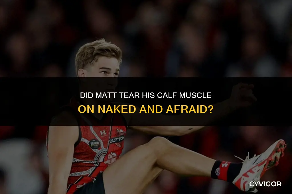 did matt tear his calf muscle on naked and afraid