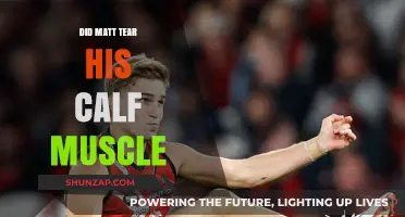Did Matt Tear His Calf Muscle? Understanding the Injury and Recovery Process