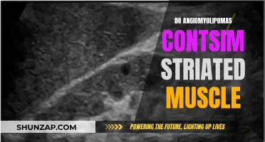Angiomyolipomas: Striated Muscle Composition Mystery