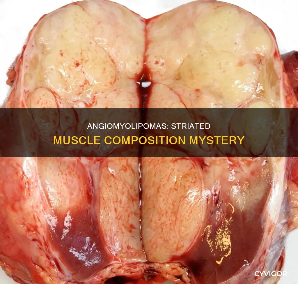 do angiomyolipomas contsim striated muscle