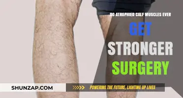 Reviving Strength: Can Atrophied Calf Muscles Regain Power Post-Surgery?