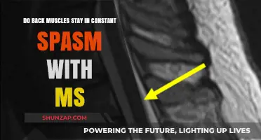 Understanding MS: Do Back Muscles Stay in Constant Spasm?