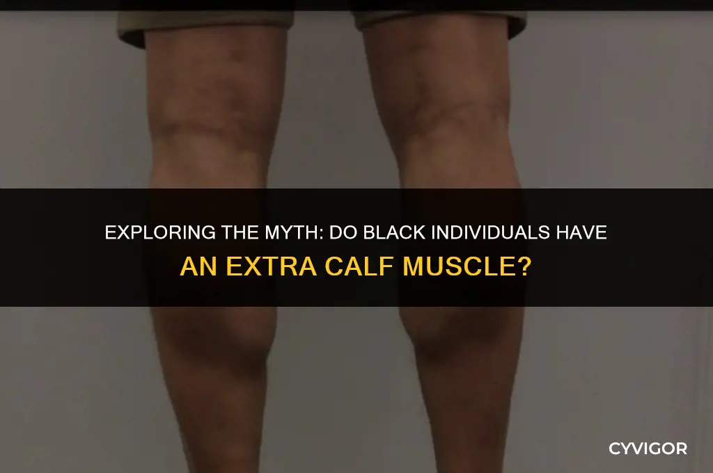 do bkacks have an extra muscle on their calf