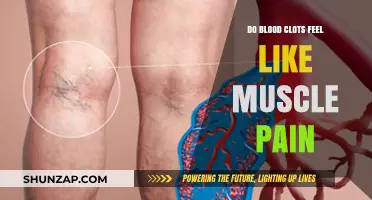 Blood Clots vs. Muscle Pain: Recognizing the Difference and Symptoms
