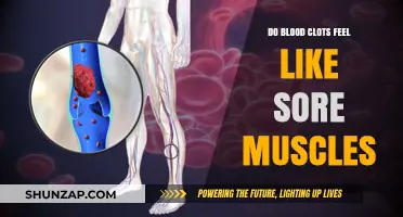 Blood Clots vs. Sore Muscles: Recognizing the Difference in Pain