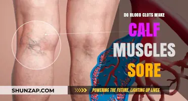 Can Blood Clots Cause Calf Muscle Soreness? Symptoms and Risks