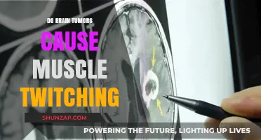 Brain Tumors: Can They Cause Muscle Twitching?