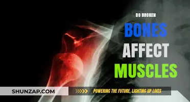 Unraveling the Impact: How Broken Bones Influence Muscle Health