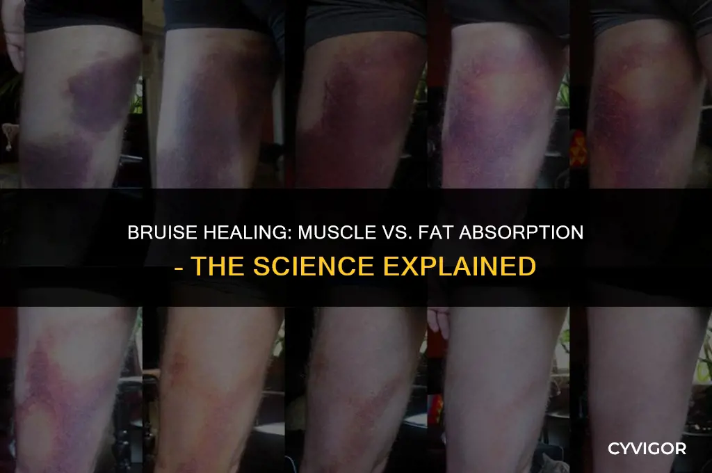 do bruises get absorbed better by muscle or fat