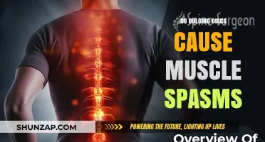 Bulging Discs and Muscle Spasms: What's the Link?