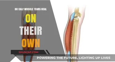 Can Calf Muscle Tears Heal Without Medical Intervention?