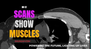 Understanding CT Scans: Muscle Visibility and Imaging