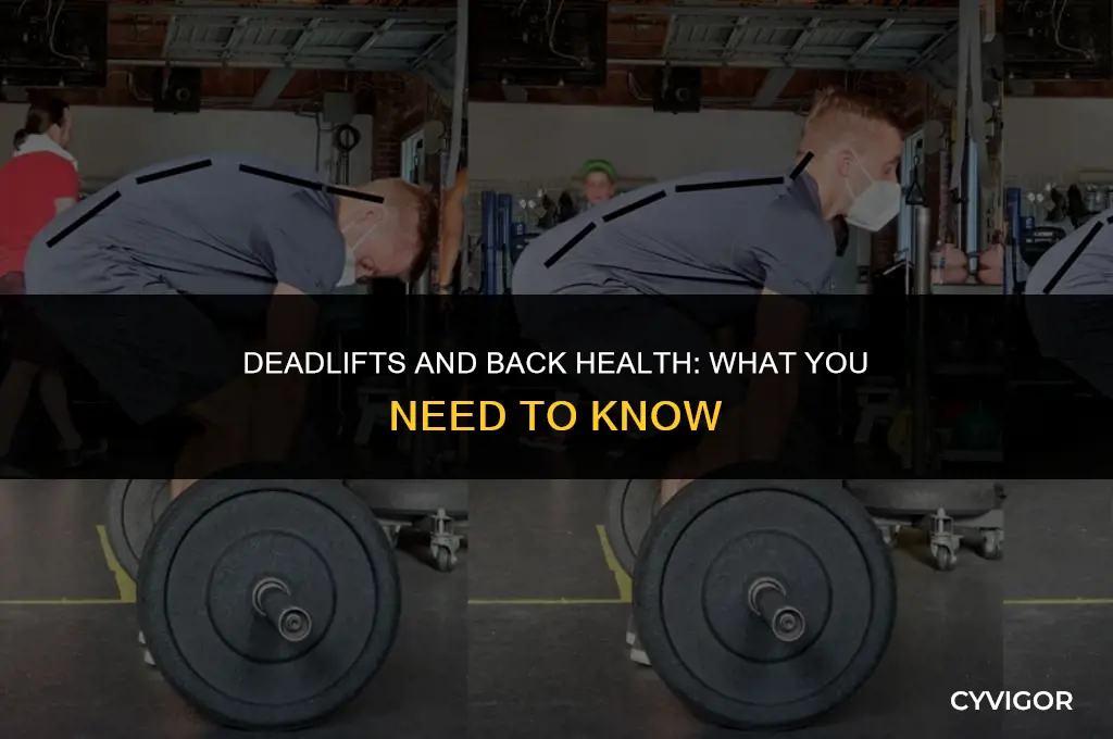 do deadlifts hurt back if you have no back muscle