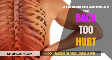 Degenerative Discs: Back Muscle Pain Connection?