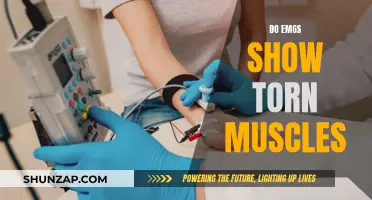 EMG Tests: Can They Detect Torn Muscles?