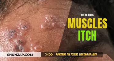 Healing Muscles: Why the Itch?