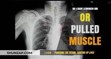 Broken Rib or Pulled Muscle: How to Tell the Difference