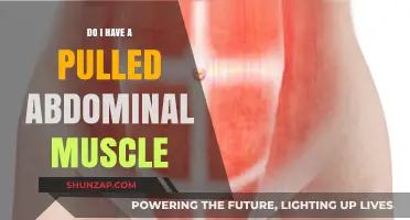 Pulled Abdominal Muscle: Symptoms, Causes, and Recovery Tips Explained