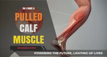 Pulled Calf Muscle: Symptoms, Causes, and Recovery Tips Explained
