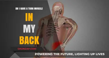 Back Pain Blues: Could You Have a Torn Muscle?