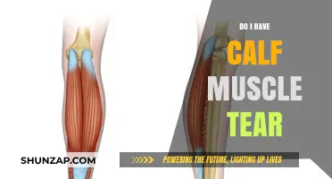 Could You Have a Calf Muscle Tear? Signs and Symptoms to Look Out For
