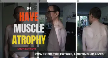 Understanding Muscle Atrophy: Signs, Symptoms, and Diagnosis