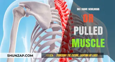 Scoliosis or Pulled Muscle: How to Tell the Difference