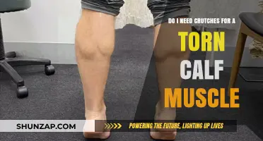 Recovering from a Torn Calf Muscle: Are Crutches Necessary?