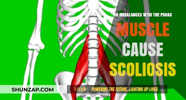 Psoas Muscle Imbalances: A Cause of Scoliosis?