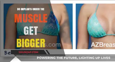 Understanding Breast Implant Size: Do Under-the-Muscle Implants Increase in Size?