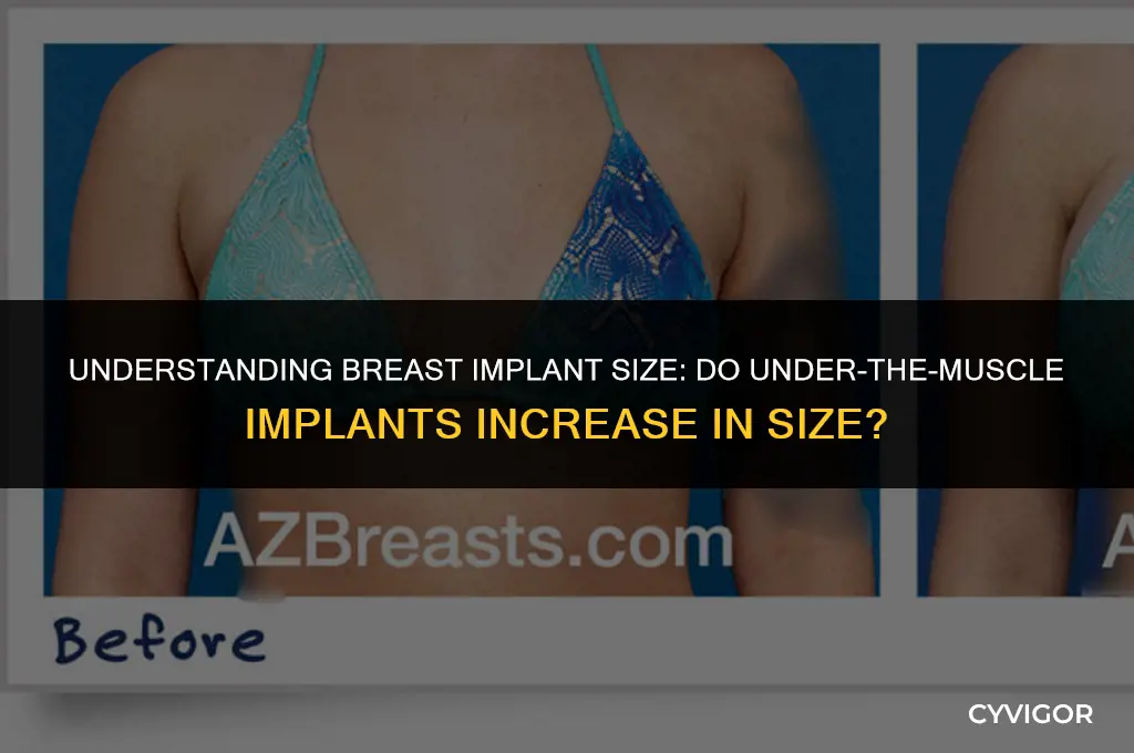 do implants under the muscle get bigger