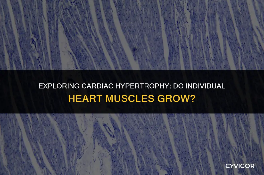 do individual cardiac muscles get bigger