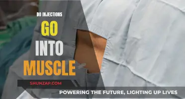 Injections: Muscle or Not?
