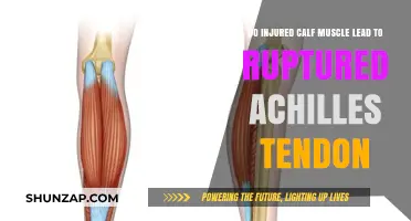 From Strain to Snap: The Link Between Calf Injuries and Achilles Ruptures