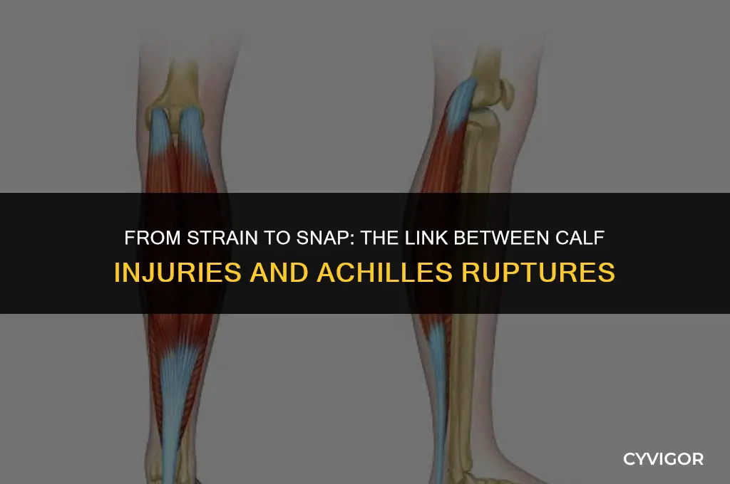 do injured calf muscle lead to ruptured achilles tendon