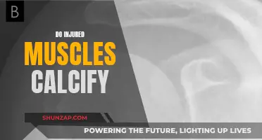 Injured Muscles: Can They Heal as Calcified Tissue?