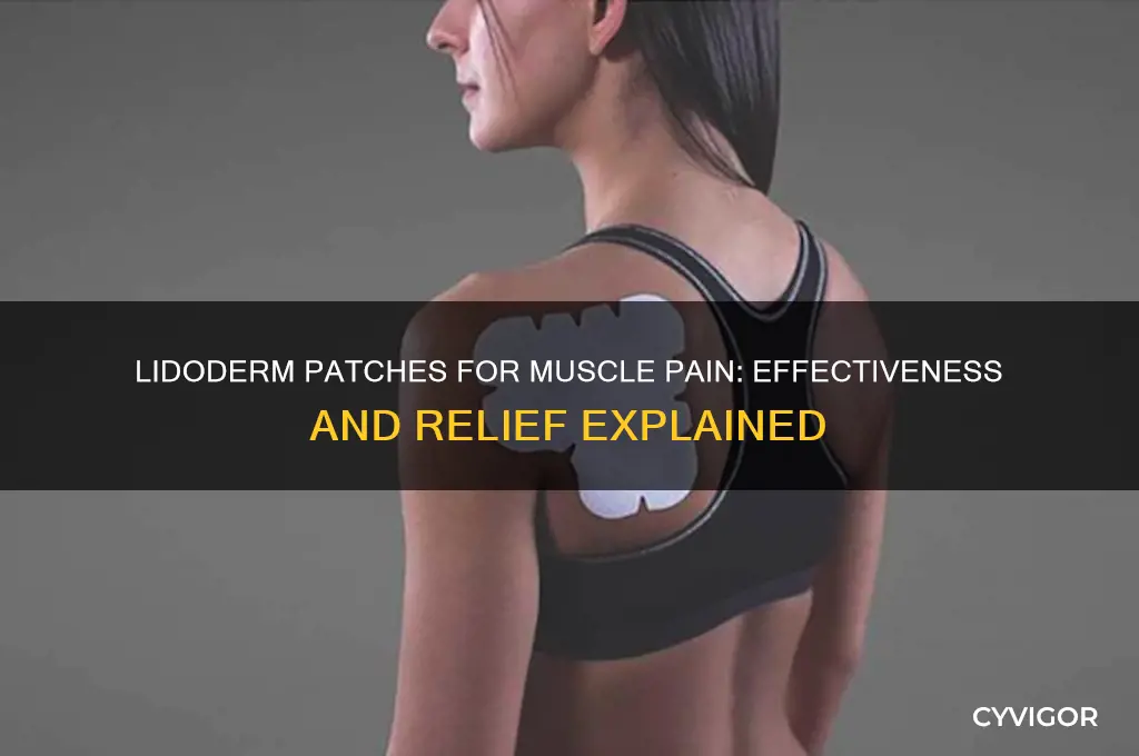 do lidoderm patches work for muscle pain