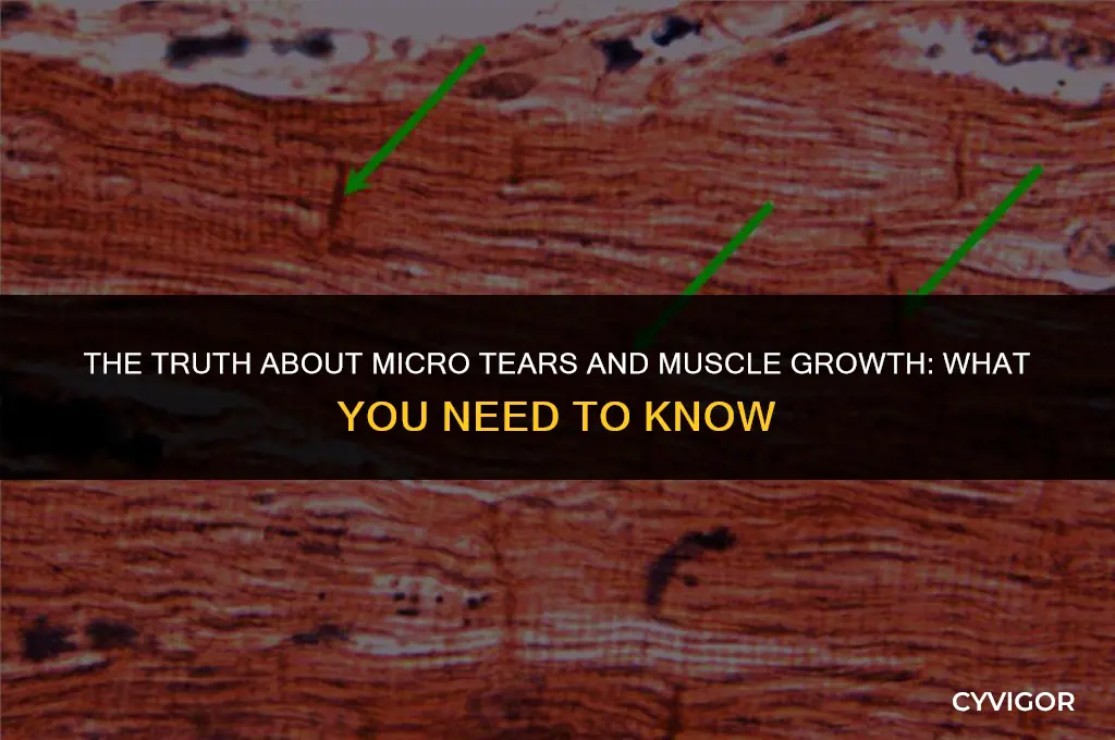 do micro tears build muscle