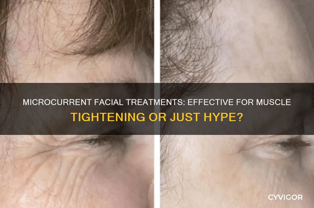 do microcurrent treatments work for facial muscle tightening